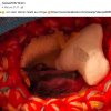 Update 11. Mai Notfälle